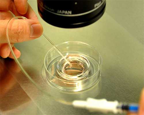 50岁绝经女性能否服用DHEA调理卵巢并探讨助孕选择