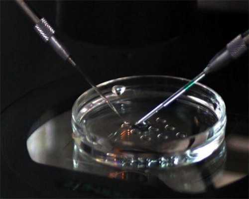 2026年未婚女性俄罗斯试管指南与供精申请步骤